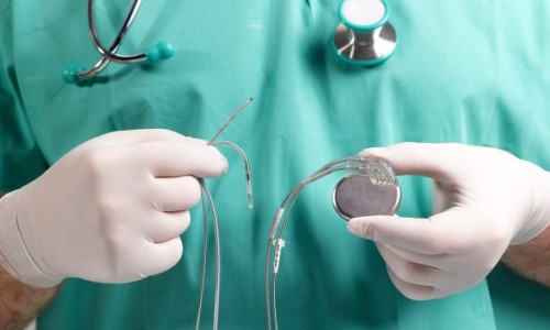 Thu hồi 62000 máy tạo nhịp tim do nguy cơ chập điện