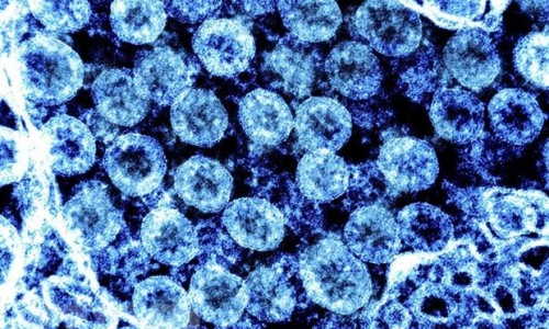 Trung Quốc phát hiện kháng thể có thể chống lại mọi biến thể SARS-CoV-2