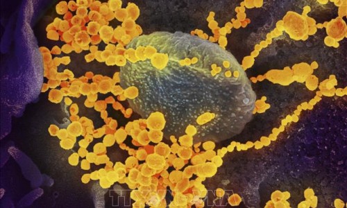 Hà Lan phát hiện đường dây buôn bán virus SARS-CoV-2 làm lây lan COVID-19