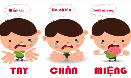 Bộ Y tế cảnh báo xu hướng gia tăng ca tay chân miệng