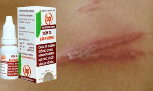 Thu hồi thuốc viêm da Bảo Phương do không đạt chuẩn chất lượng