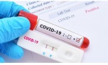 Các cơ sở y tế tư nhân không được tăng giá xét nghiệm COVID-19