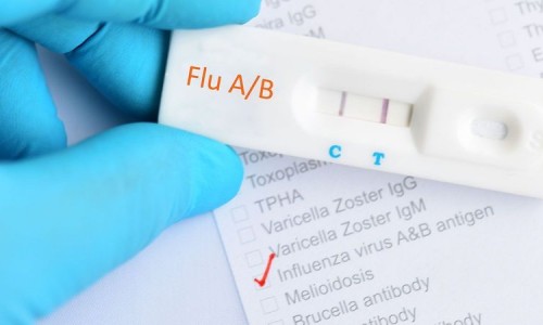 Kit test cúm A loạn giá thị trường, chuyên gia khuyến cáo