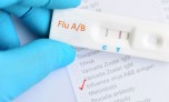 Kit test cúm A loạn giá thị trường, chuyên gia khuyến cáo