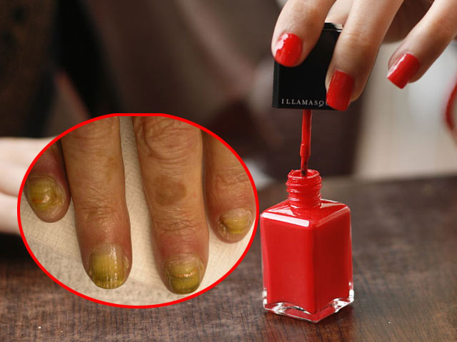 Sơn móng tay Trung Quốc giá rẻ và những nguy cơ tiềm ẩn phía sau