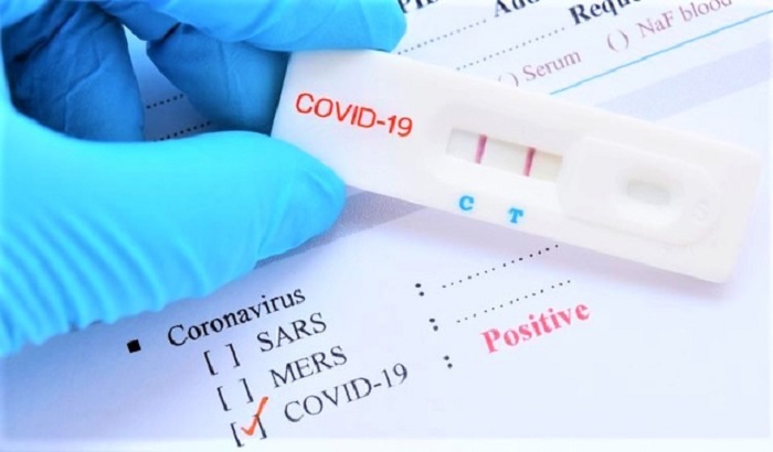 Hà Nội được phép dùng kết quả test nhanh xác định F0