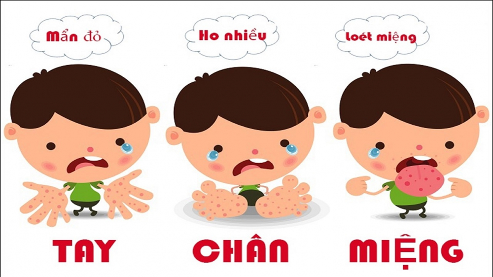 Bộ Y tế cảnh báo xu hướng gia tăng ca tay chân miệng